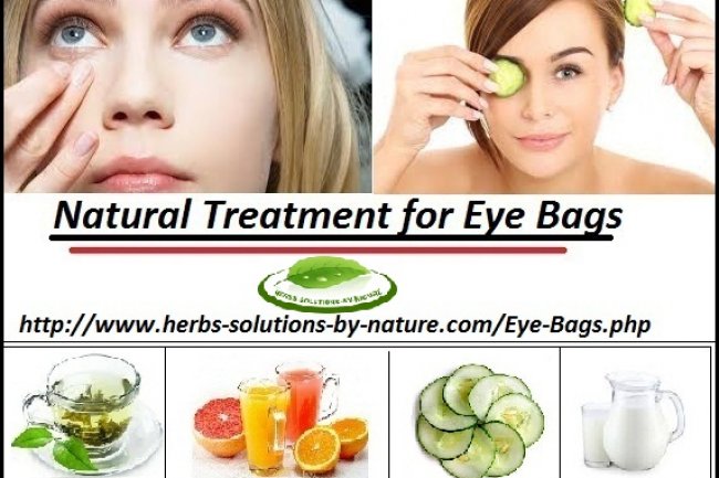 9 Natural Remedies for Eye Bags Best Cure for Puffy Eyes at Your Home