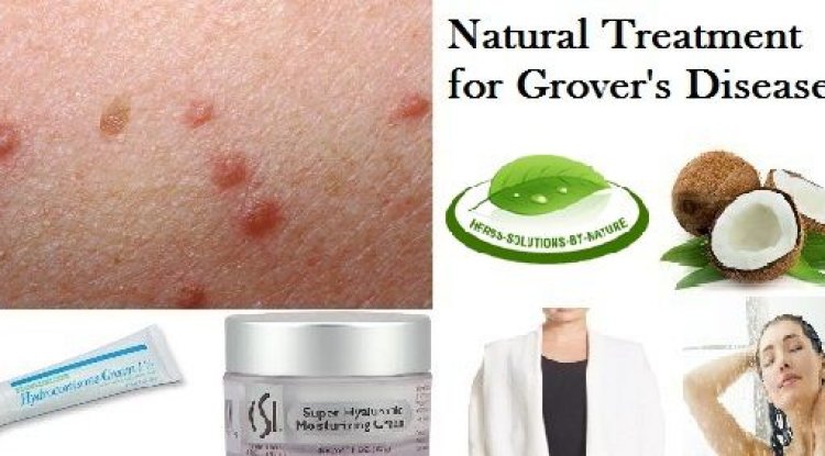 Enfermedad de lyme tratamiento natural