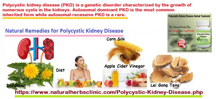 5 Natural Remedies For Polycystic Kidney Disease