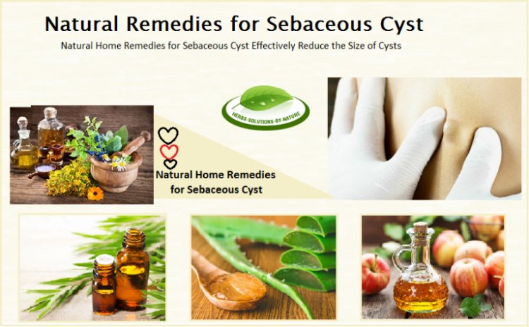 5 Natural Remedies For Sebaceous Cyst Help To Reduce The Size Of Cyst