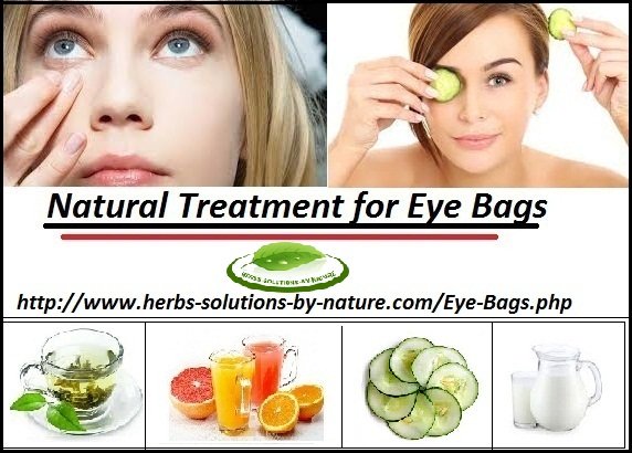 9 Natural Remedies for Eye Bags Best Cure for Puffy Eyes at Your Home