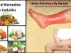 Natural Remedies for Cellulitis Treat with Natural Essential Oils