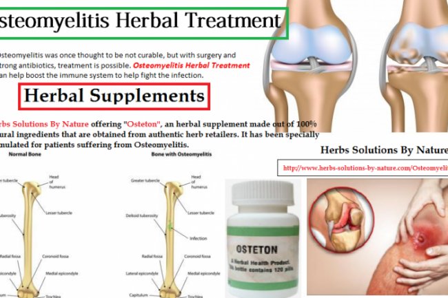 Natural Remedies for Osteomyelitis Use Healthy Diet and Vitamins