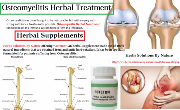 Natural Remedies for Osteomyelitis Use Healthy Diet and Vitamins