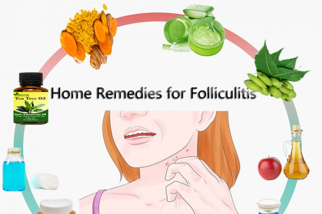 Home Remedies for Folliculitis