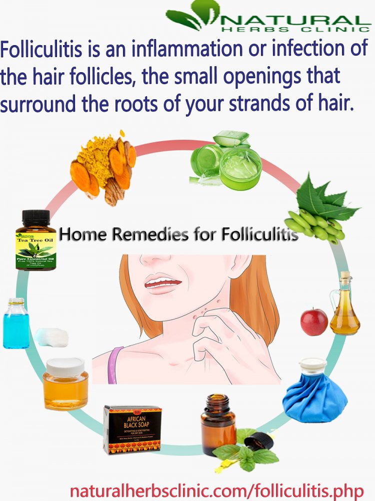 Home Remedies for Folliculitis