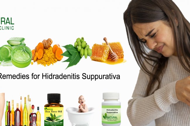 Natural Remedies for Hidradenitis Suppurativa