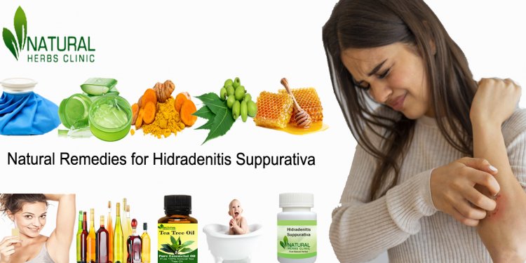 Natural Remedies for Hidradenitis Suppurativa