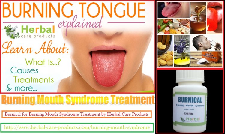 Burning Mouth Syndrome How Effects on Your Life