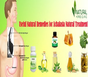 Useful Natural Remedies for Achalasia Natural Treatment