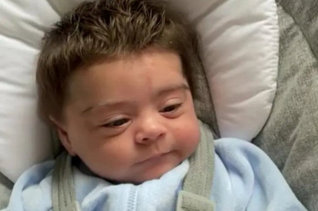 Newborn baby having thick hair on head goes viral
