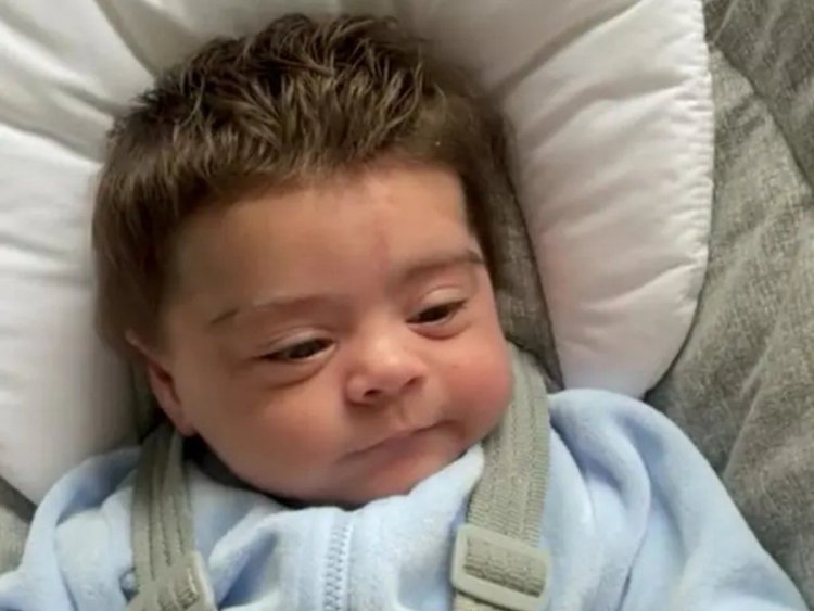 Newborn baby having thick hair on head goes viral