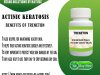 Treneton Actinic Keratosis Cure at Home Naturally