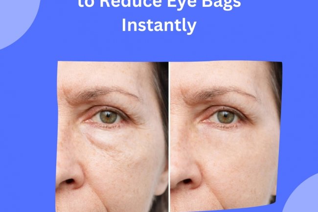 Best Vitamins and Minerals to Reduce Eye Bags Instantly