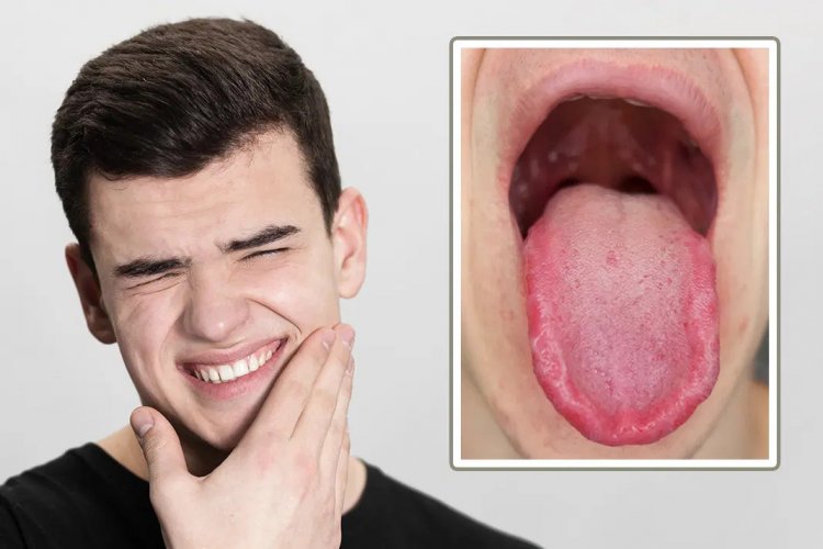 Heal Your Mouth Naturally: The Ultimate Guide to Burning Mouth Syndrome Relief